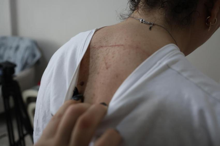 İzmir'de ev sahibi dehşeti! Kedi besleyen kiracılarını çift çivili sopalarla dövdüler