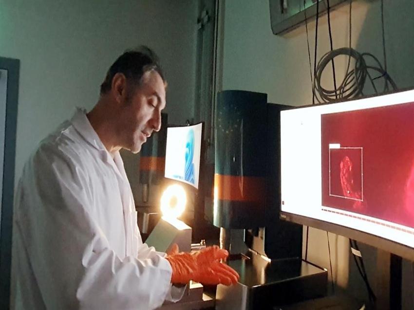 Türk profesör dünyada ses getirdi! 'Kafatasında bekleyip beyine sinsice sızıyor'