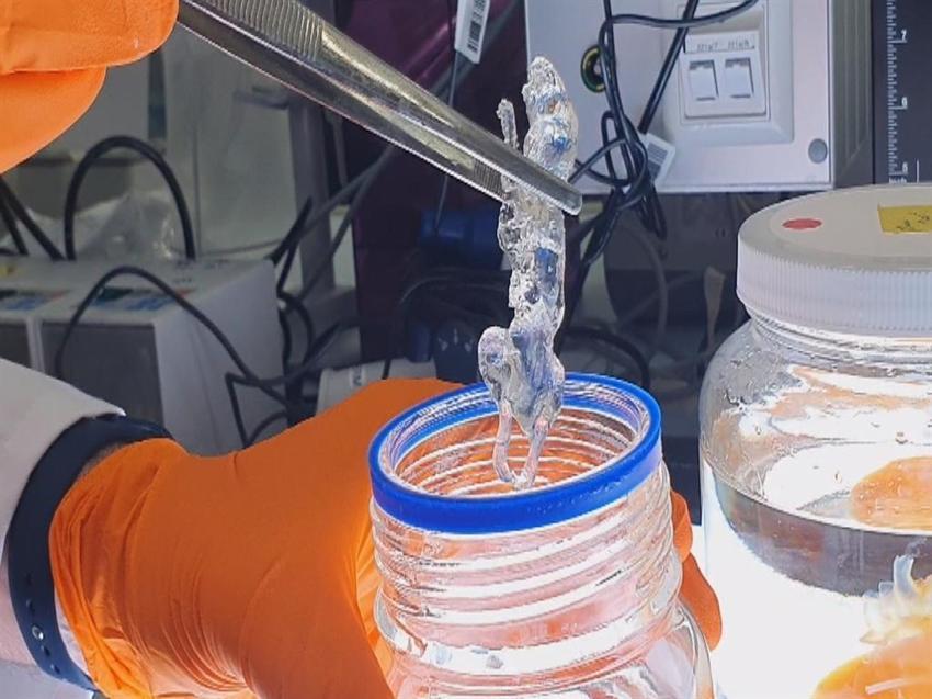 Türk profesör dünyada ses getirdi! 'Kafatasında bekleyip beyine sinsice sızıyor'