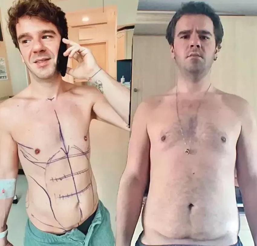 İbrahim Tatlıses zayıflama sırrını paylaştı! Tam 21 kilo verdi