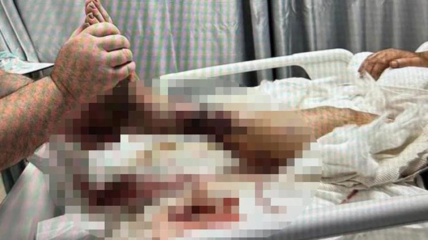 Pitbull saldırısında bacağını kaybetmişti! Savcı köpeğin sahibine ve bakıcısına hapis cezası istedi