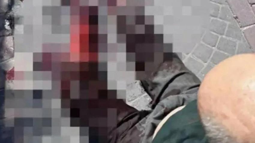 Pitbull saldırısında bacağını kaybetmişti! Savcı köpeğin sahibine ve bakıcısına hapis cezası istedi