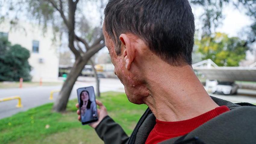 Türkiye'nin ilk yüz naklinin yıl dönümünde duygusal buluşma! Yüz nakli olan Uğur Acar donör Ahmet Kaya'nın kızıyla görüştü