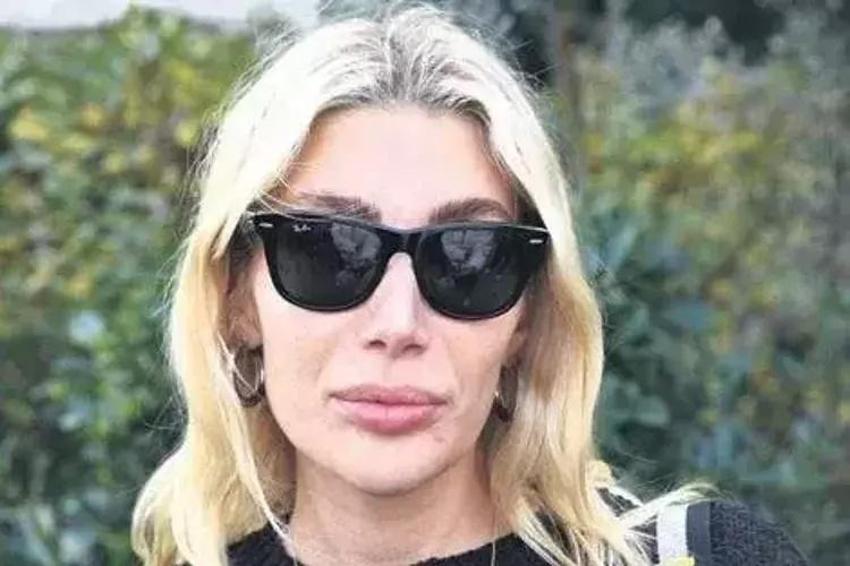 İrem Derici kaza geçirdi! 'Tedavi olacağım'