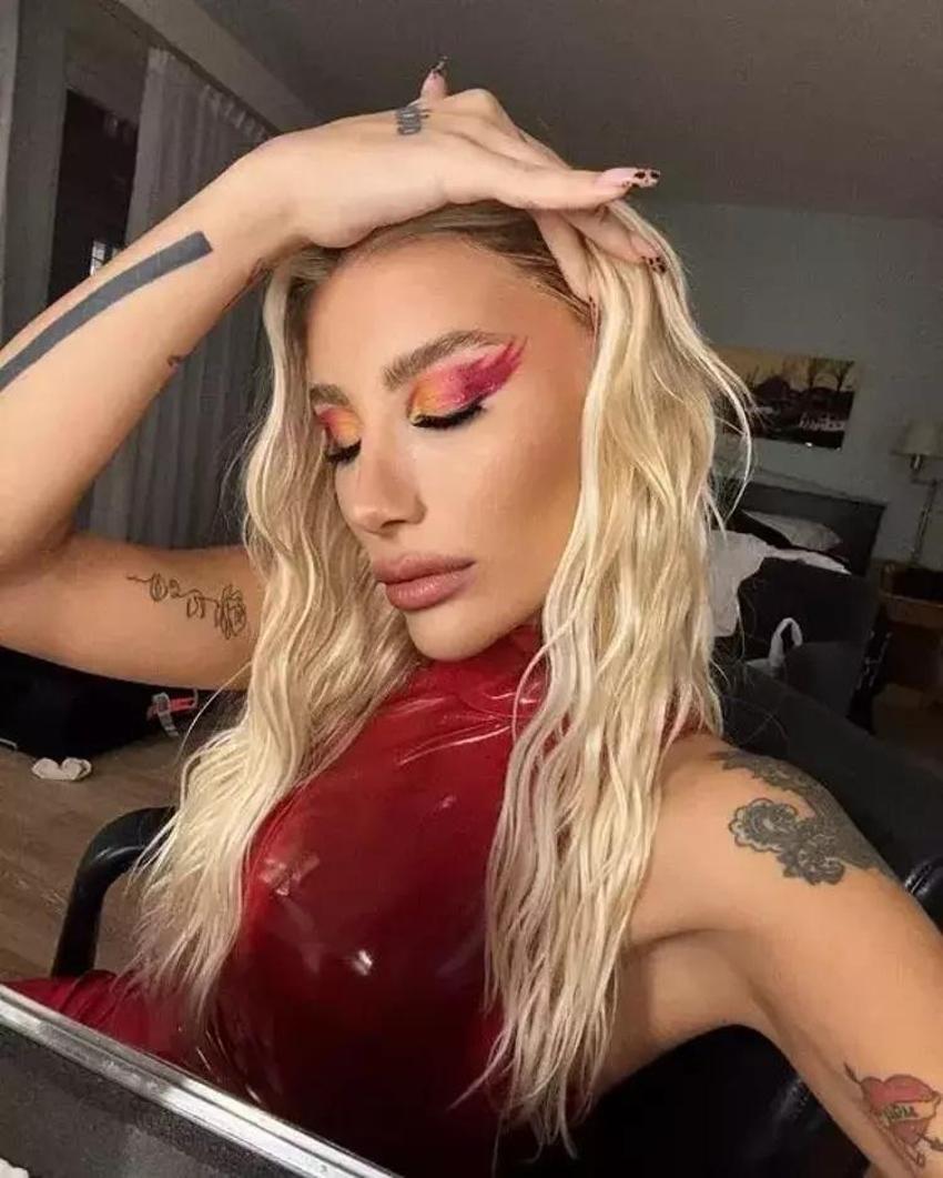 İrem Derici kaza geçirdi! 'Tedavi olacağım'