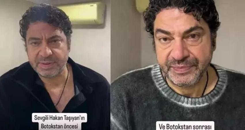 Hakan Taşıyan ikinci hayatını yaşıyor! Estetik ameliyatıyla çok değişti