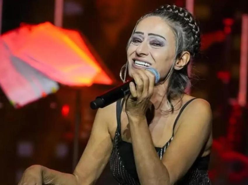 Yüzü yanmıştı! Yıldız Tilbe son halini sahnede gösterdi
