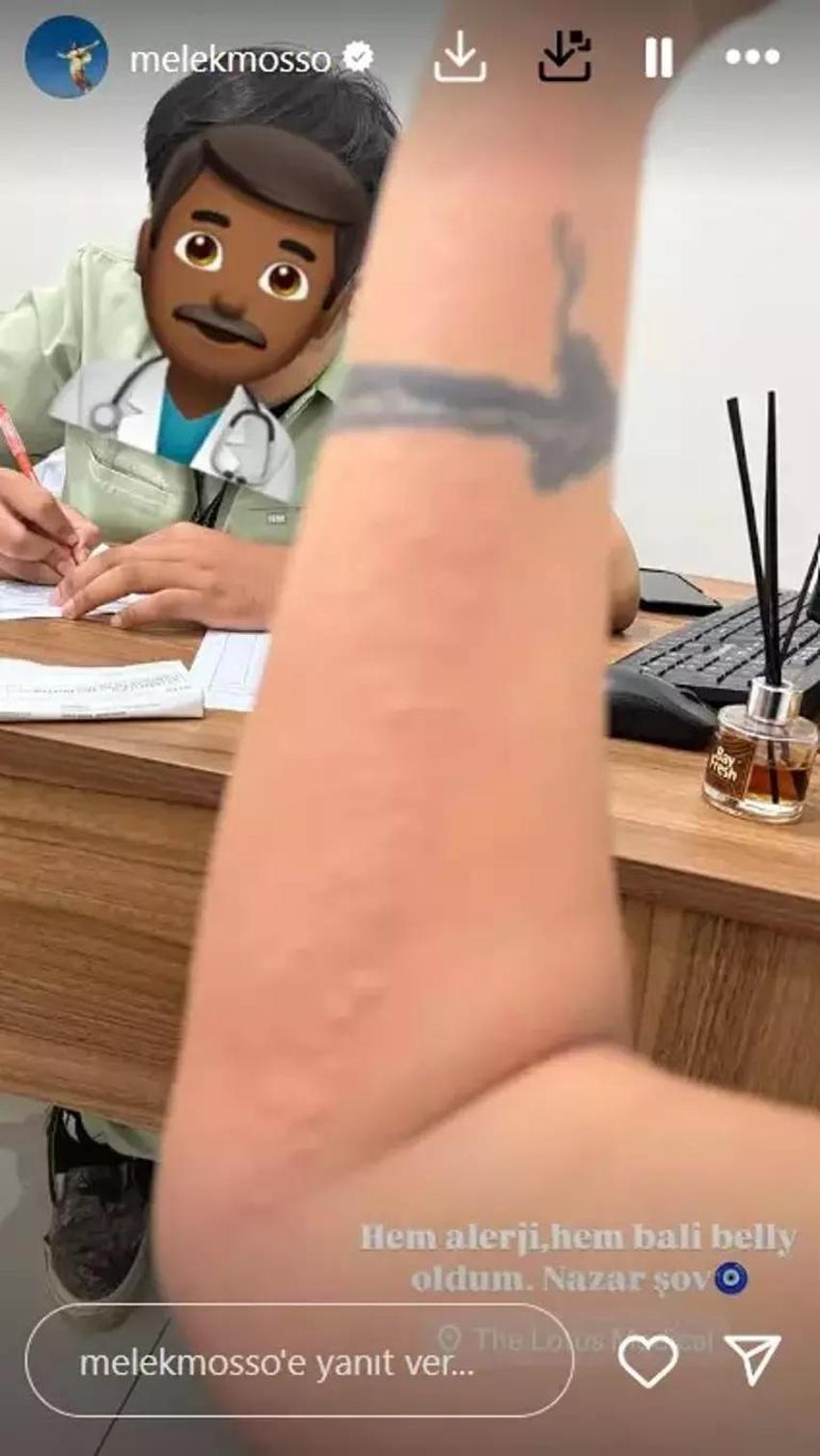 Melek Mosso tatilde hastanelik oldu! Paylaşımı korkuttu