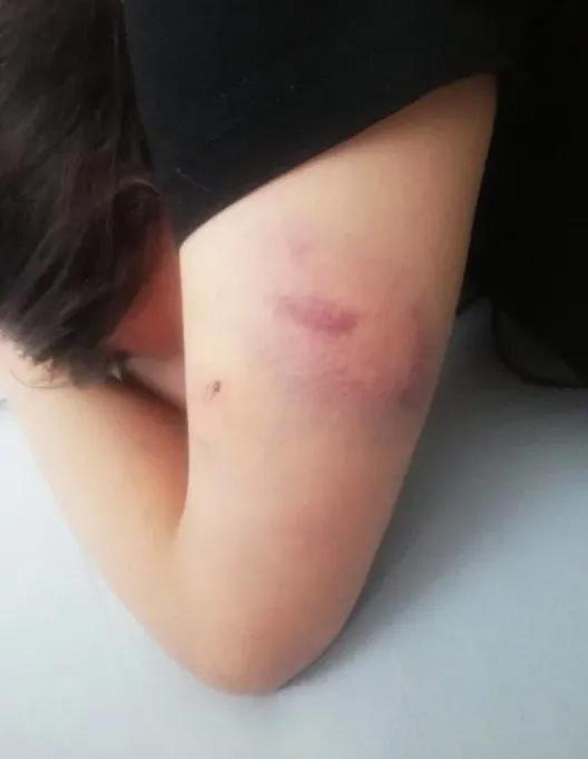 Saçlarını kestiler, vücudunda sigara söndürdüler! Konya'da dehşet veren işkence davasında karar: Demet Aydın’a rezidansta işkence edenlerin cezası belli oldu!