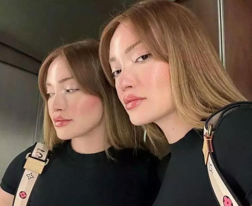 Danla Biliç eski sevgilisi tarafından darp edildi; KADES'ten yardım istedi