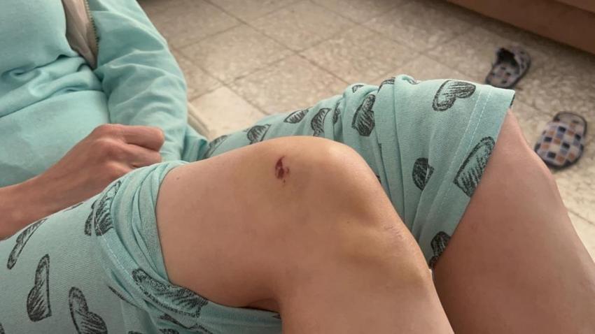 Köpek saldırısı sonrası sokağa çıkmaz hale geldi!