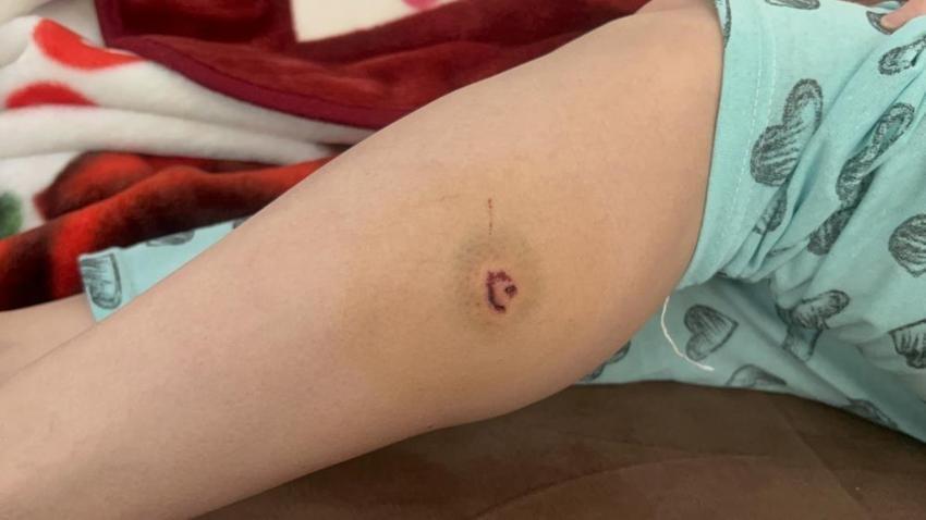 Köpek saldırısı sonrası sokağa çıkmaz hale geldi!