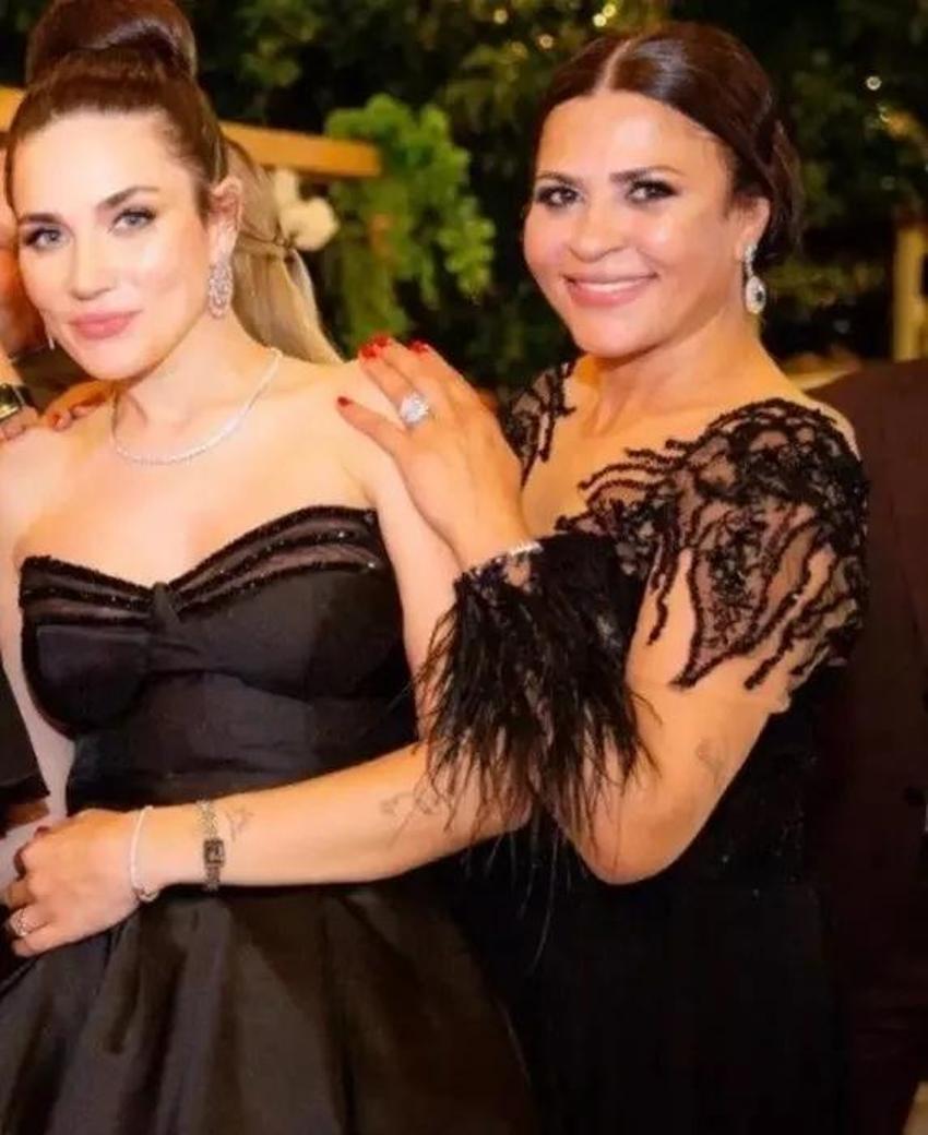 Buse Varol ilk kez açıkladı! 'Alişan yandı'