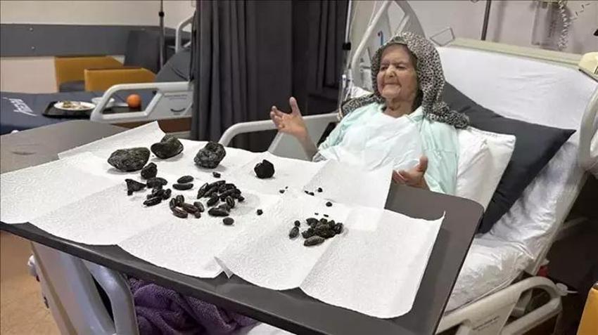 Eşini kaybetti 92 yaşında kızına sığındı! Hastalığını keşfeden doktorlar bile şoke oldu