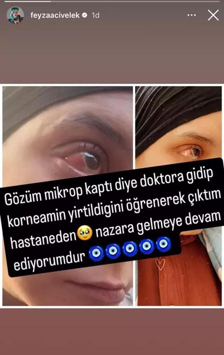 Feyza Civelek önce kolunu kırdı sonra gözünü bozdu!