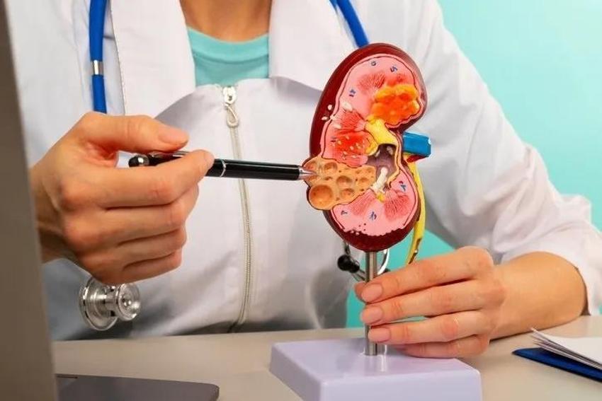 Belirtisi kötü oldu! Günde 3 litre kola içenin böbreklerin çıkanlara kimse inanamadı
