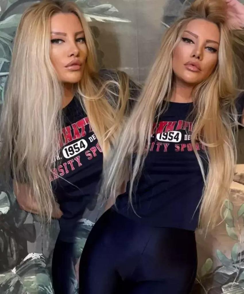 Estetik ameliyatı 9 saat süren Gülşah Saraçoğlu son halini paylaştı!
