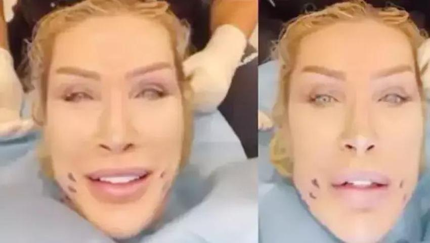 Estetik ameliyatı 9 saat süren Gülşah Saraçoğlu son halini paylaştı!