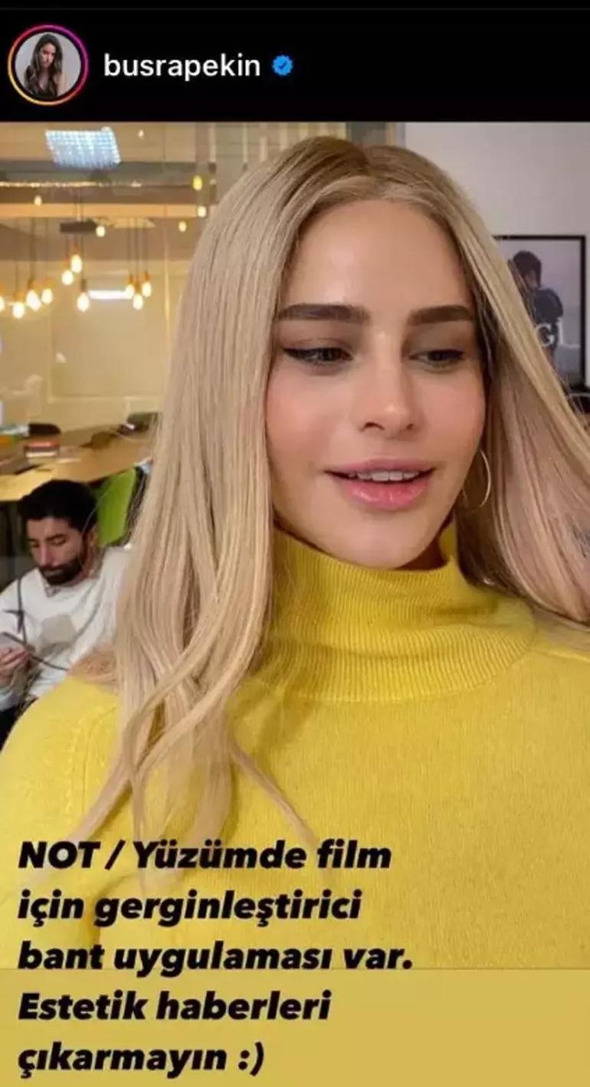 Estetik ameliyatı 9 saat süren Gülşah Saraçoğlu son halini paylaştı!