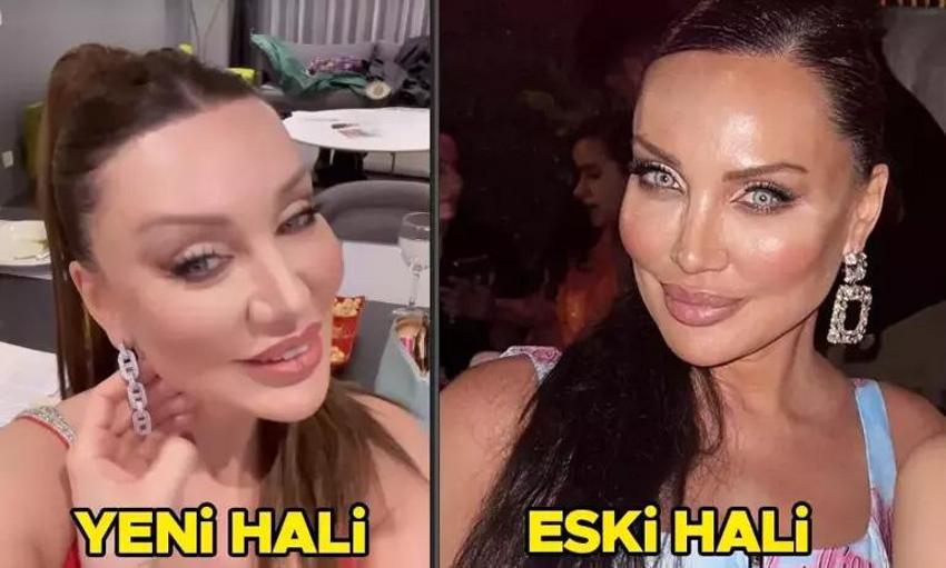 Estetik ameliyatı 9 saat süren Gülşah Saraçoğlu son halini paylaştı!