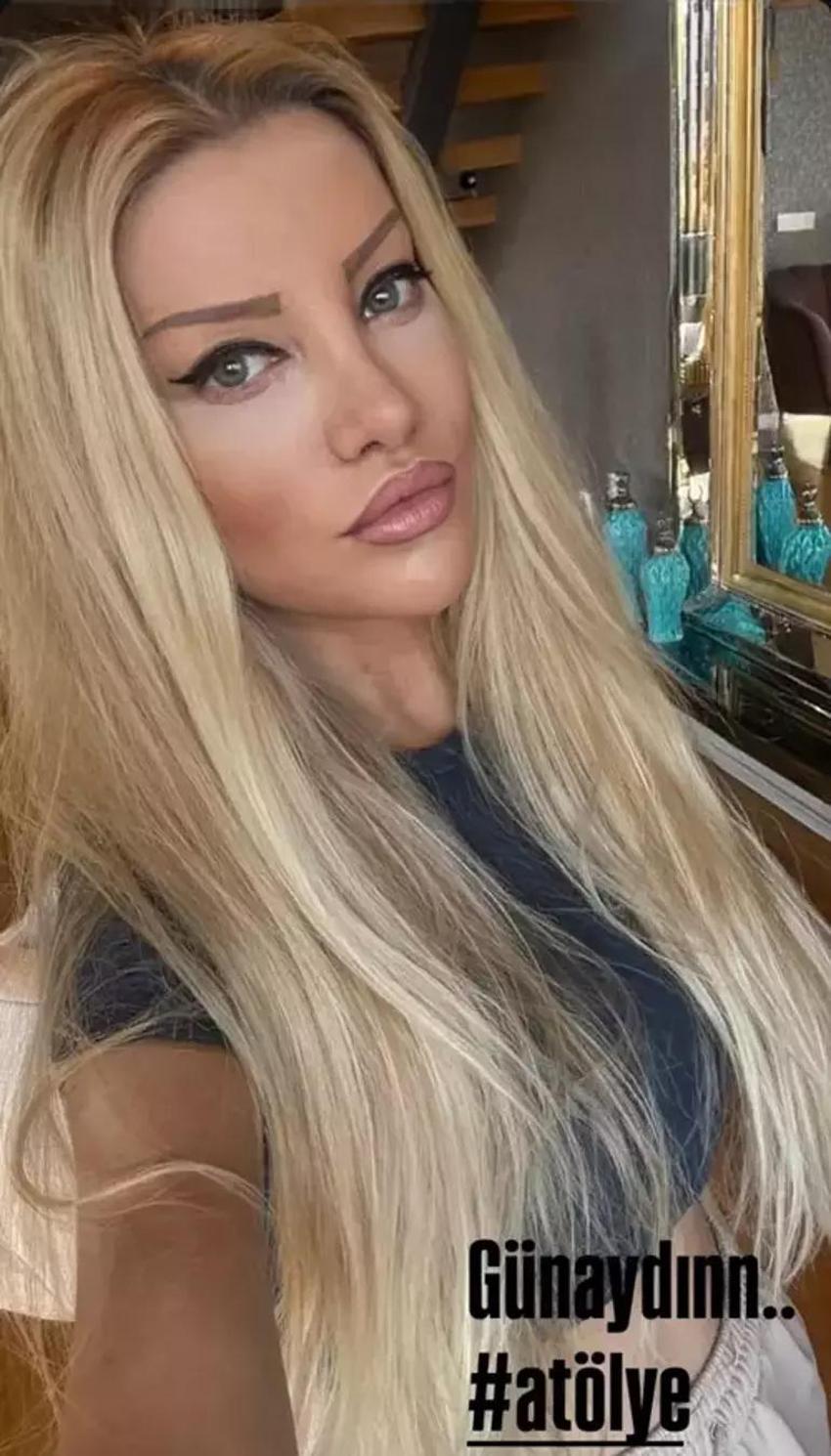 Estetik ameliyatı 9 saat süren Gülşah Saraçoğlu son halini paylaştı!