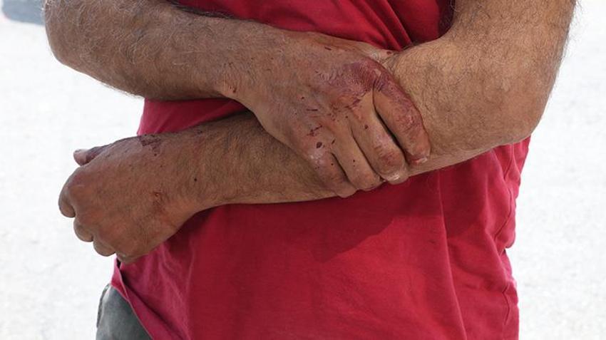 Yurttan acemi kasap manzaraları! İlk görüntüler Samsun'dan geldi