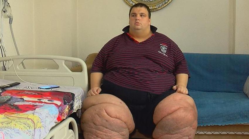 270 kilo olan Mehmet, tedavisi için yardım istiyor: 15 aydır bu odaya kilitlenip kaldım, kurtulmak istiyorum
