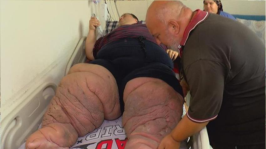 270 kilo olan Mehmet, tedavisi için yardım istiyor: 15 aydır bu odaya kilitlenip kaldım, kurtulmak istiyorum