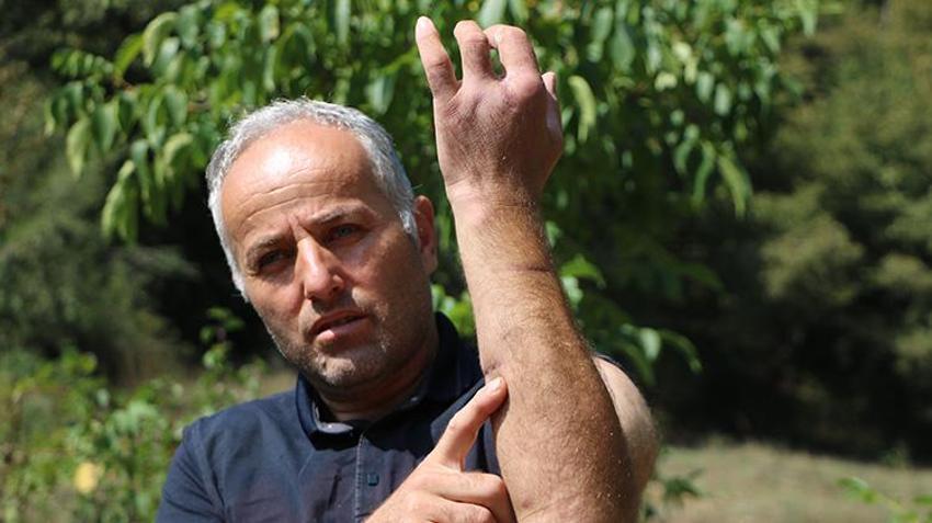 Bolu'da yıllar önce ayı saldırısından dolayı babası felç olan vatandaşa da ayı saldırdı