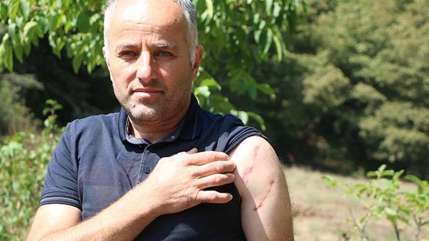 Bolu'da yıllar önce ayı saldırısından dolayı babası felç olan vatandaşa da ayı saldırdı