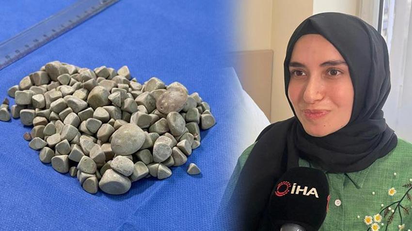 Karın ağrısı şikayetiyle gittiği hastanede literatüre girdi: Doktorlar bile şok oldu: 'Çok şaşırdık, çakıl taşı resmen'