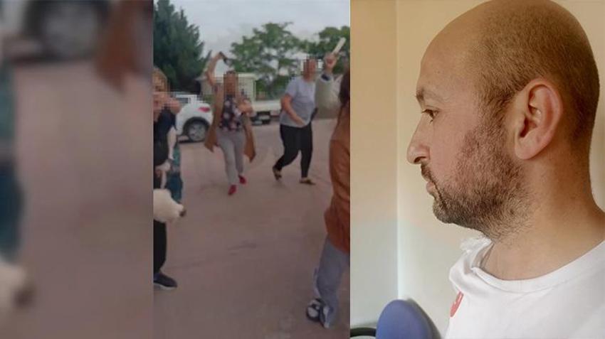 Ankara'da boşandığı eşinin yanında yaşayan oğlunu görmeye giden baba saldırıya uğradı!