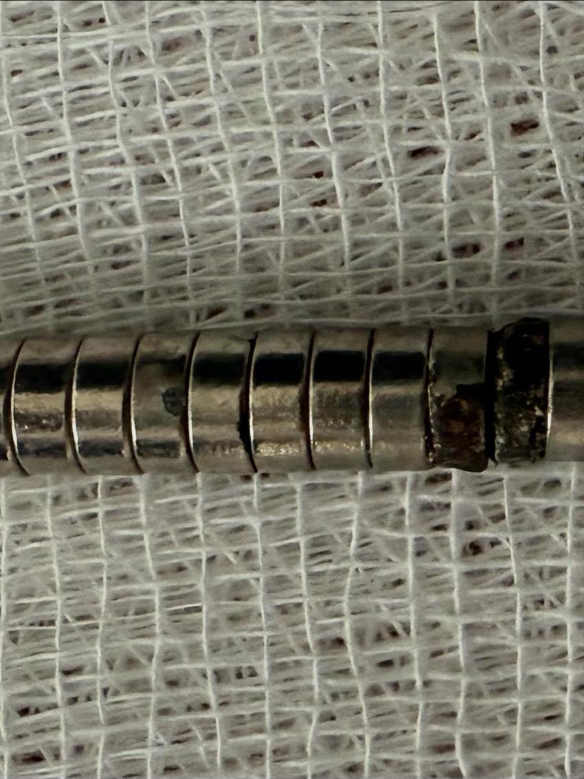 Erzurum'da 3 yaşındaki çocuğun yuttuğu 19 mıknatıs Elazığ'da endoskopiyle çıkarıldı