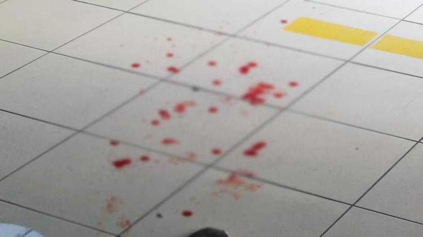 Bursa'da lisede dehşet! Öğrenciyi gasp edip müdür yardımcısının burnunu kırdılar