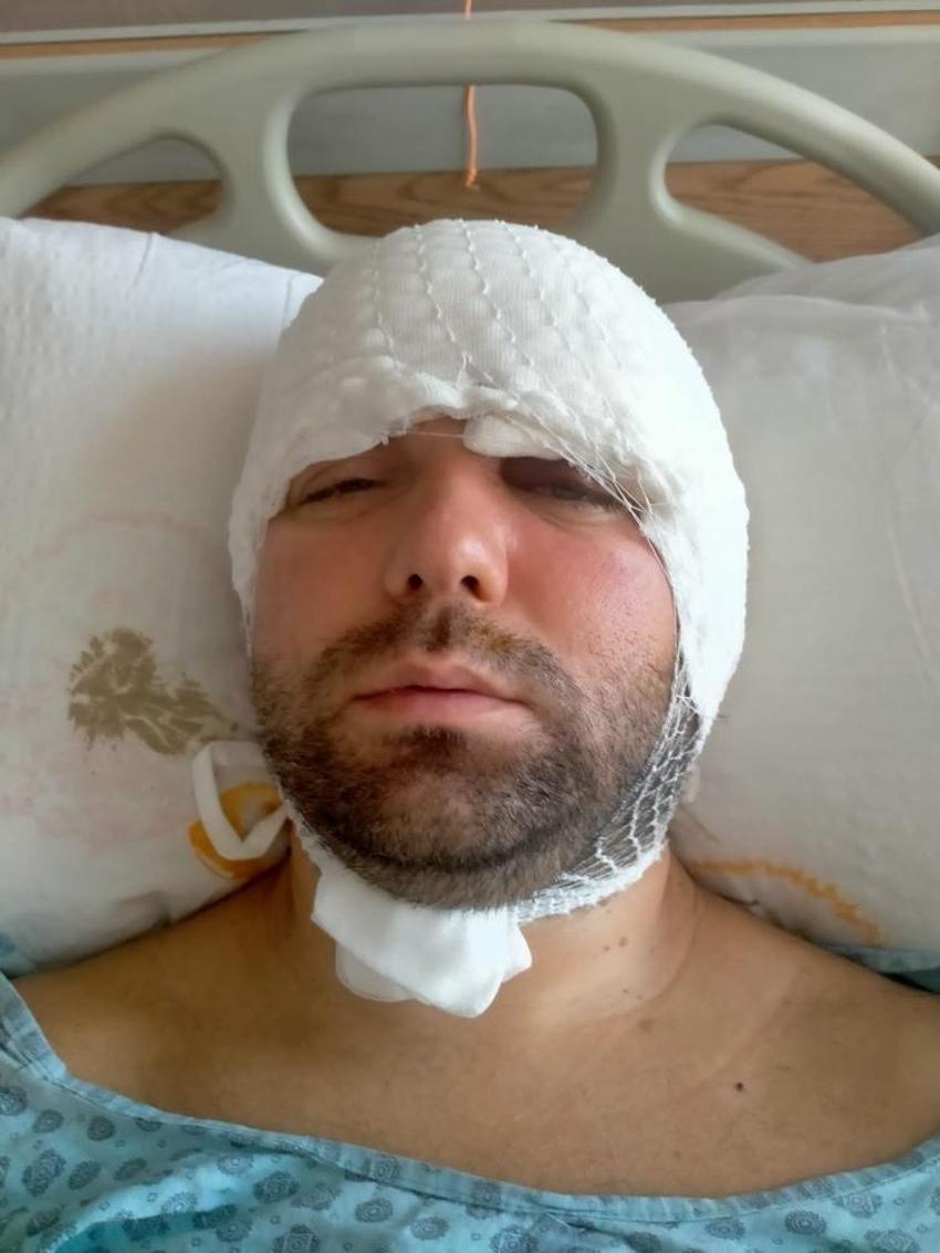 İmplant vidası çenesini delip kafatasına saplandı! 2 yıldır adalet bekliyor