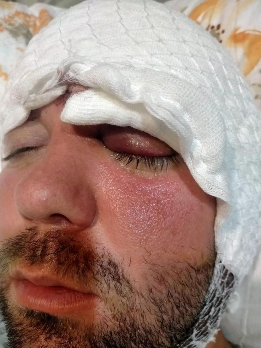 İmplant vidası çenesini delip kafatasına saplandı! 2 yıldır adalet bekliyor