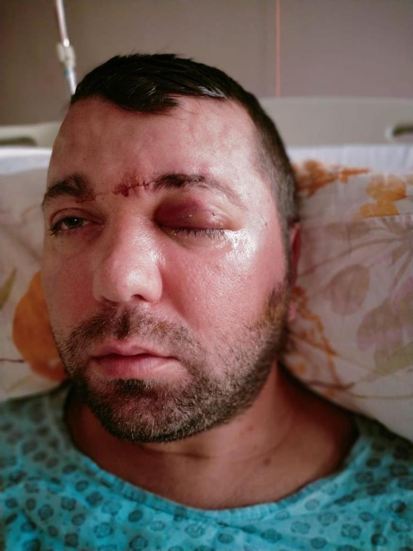 İmplant vidası çenesini delip kafatasına saplandı! 2 yıldır adalet bekliyor