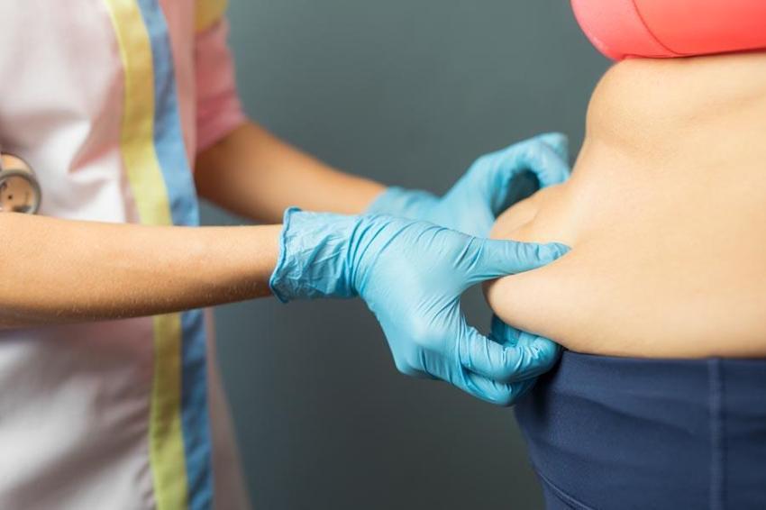 Lipödem hastalığında yaşın11’e kadar düştü! Diyetle tamamen yok olmuyor, uzman isim çaresini açıkladı