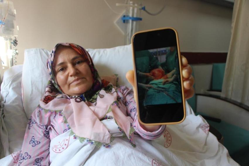 2 ayda karnı büyüdü! Doktorlar sonuca şaşırdı: Karpuz büyüklüğünde çıktı