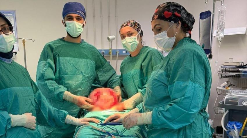 2 ayda karnı büyüdü! Doktorlar sonuca şaşırdı: Karpuz büyüklüğünde çıktı