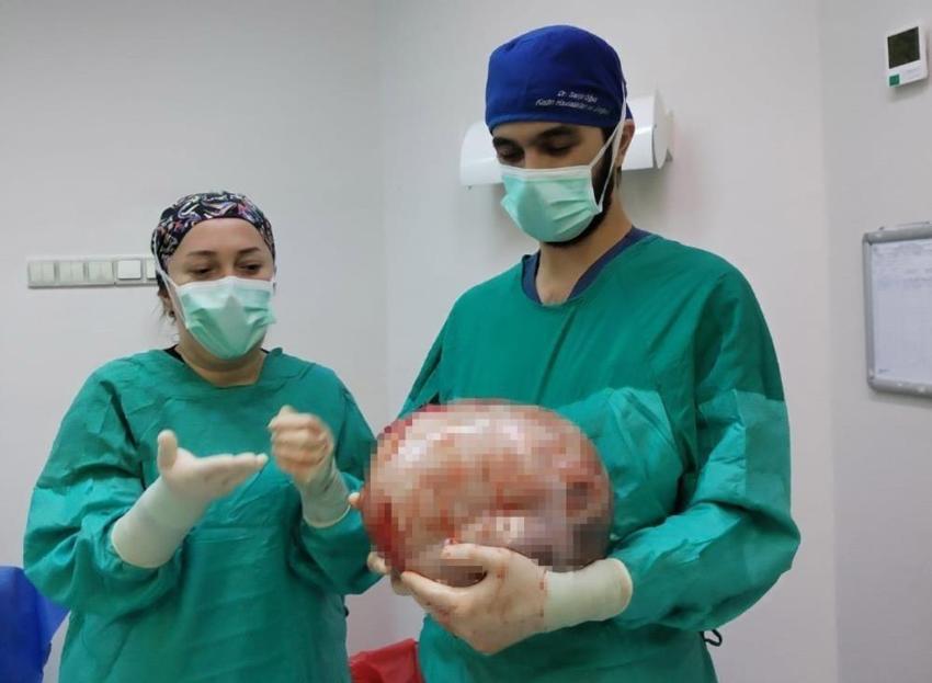 2 ayda karnı büyüdü! Doktorlar sonuca şaşırdı: Karpuz büyüklüğünde çıktı