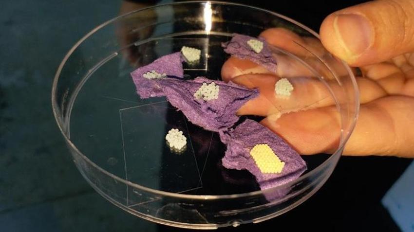 Bursalı vatandaşların kabusu oldu! Şimdiye kadar bildiklerimizin en tehlikelisi! Tüm Türkiye'ye yavaş yavaş yayılıyor!