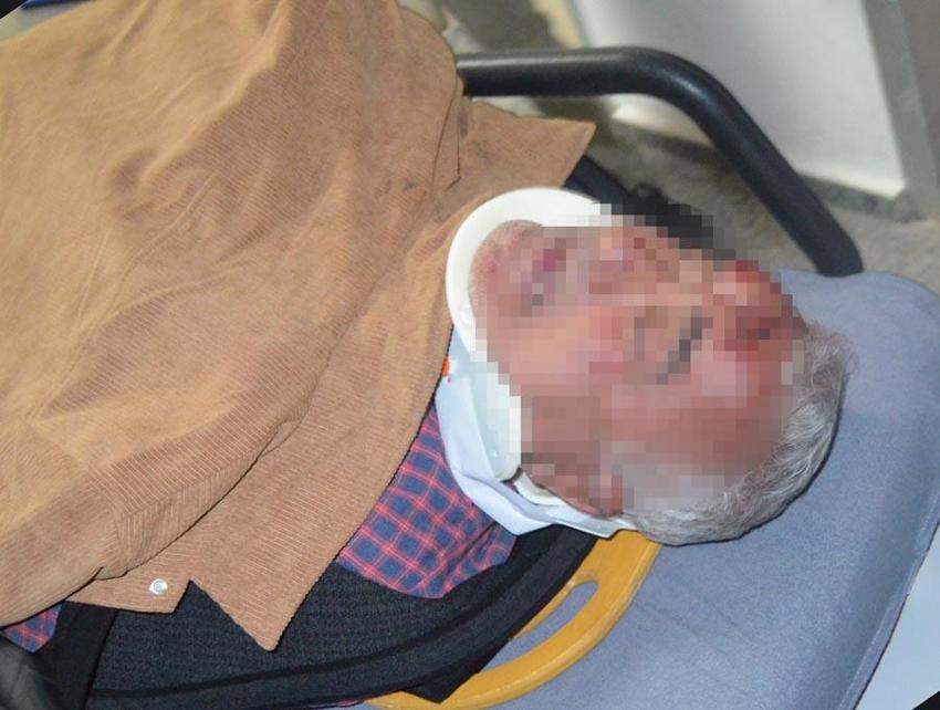 Aksaray’ın ayağa kaldıran olay! Ters yöne girip, 2 yayaya, iş yerine ve araçlara çarpan alkollü sürücü, darbedildi