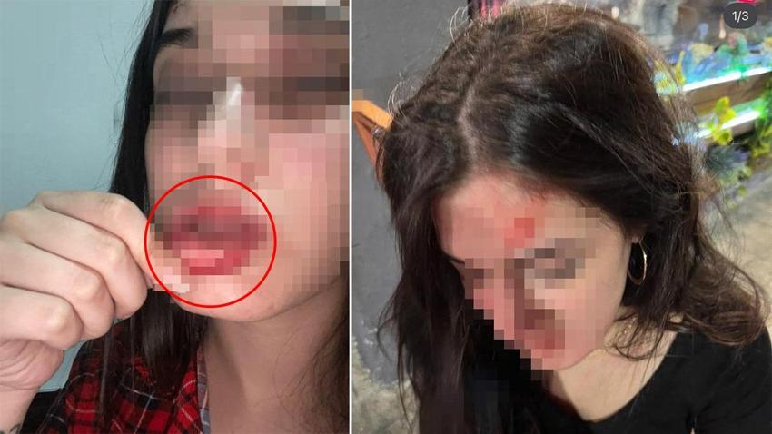 Samsun'da eski sevgili dehşeti yaşattı! Kanlı fotoğraflarını sosyal medyadan paylaştı