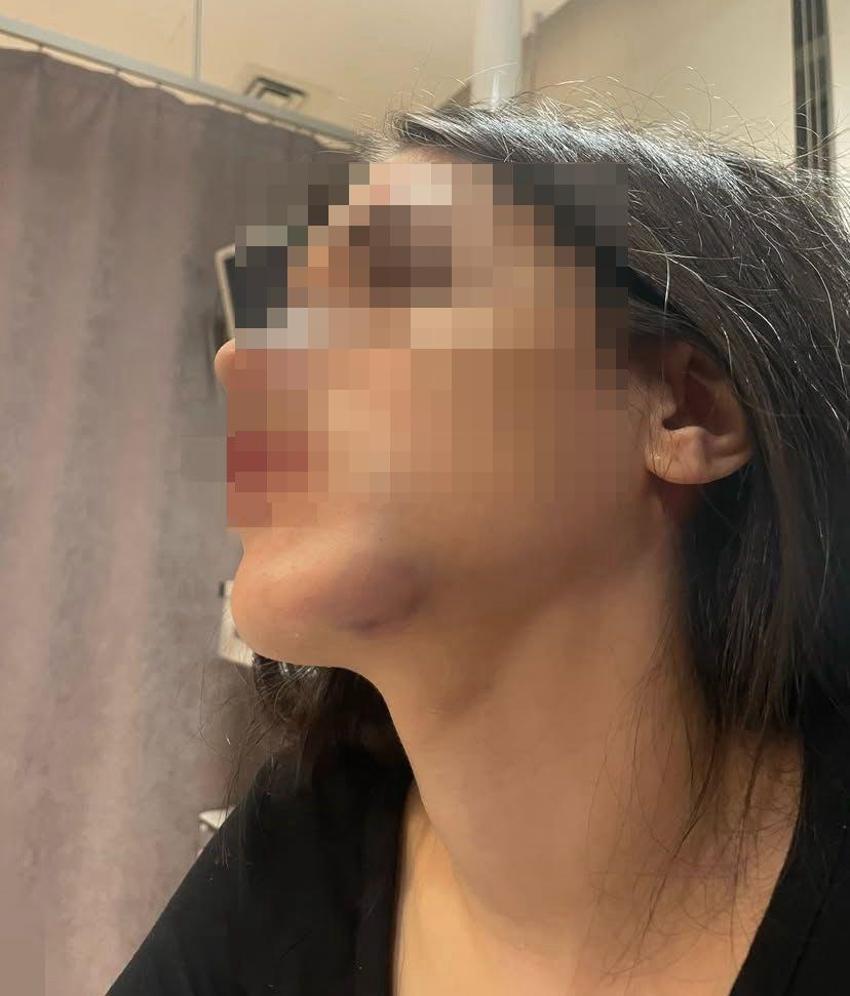 Samsun'da eski sevgili dehşeti yaşattı! Kanlı fotoğraflarını sosyal medyadan paylaştı