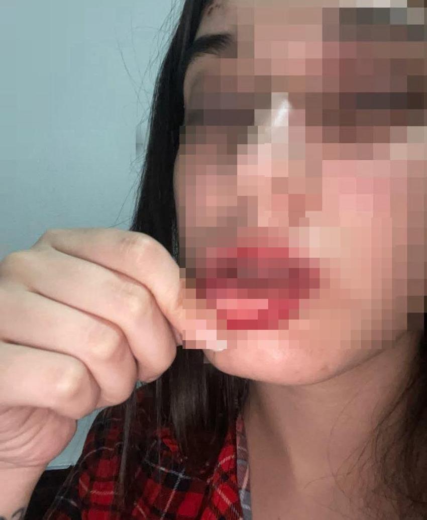 Samsun'da eski sevgili dehşeti yaşattı! Kanlı fotoğraflarını sosyal medyadan paylaştı