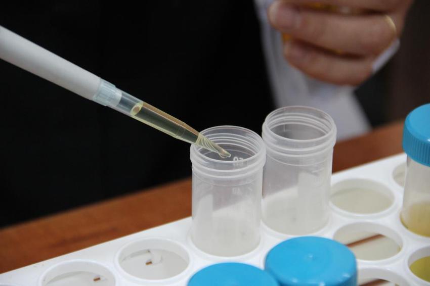 Türkiye'yi tehdit eden risk ortadan kalkıyor! 500 milyon dolarlık ihracat 'Mayalarla' kurtuluyor: TÜBİTAK destekli biyolojik savaş başladı