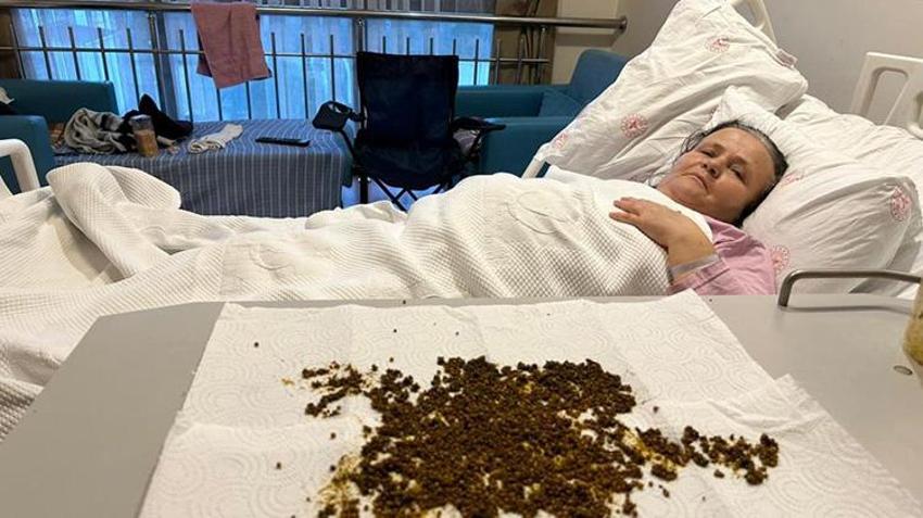 Manisa'da tıp tarihine geçecek ameliyat: Çıkan taşları sayamayınca yapay zeka tespiti yaptı!