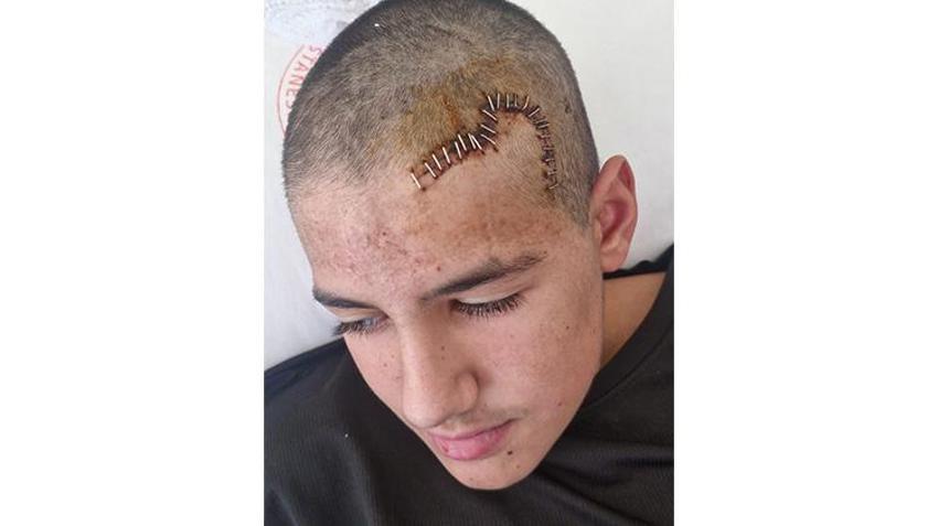 Şakalaştığı arkadaşı kafasını taşla yaraladı! Hiçbir şey olmamış gibi 'Baba tahliye' diye paylaşım yaptı