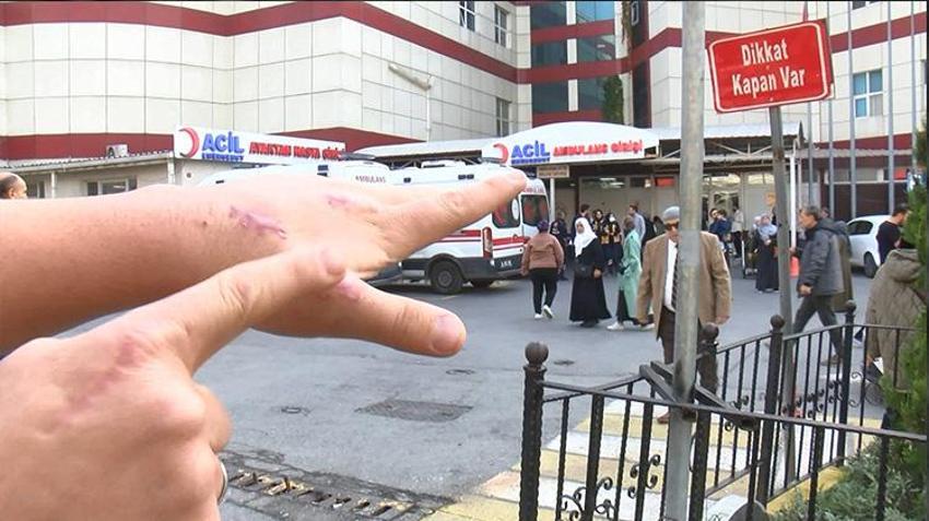 Kedisi tarafından ısırılan vatandaş antibiyotik verilerek gönderildi! Enfeksiyon kapan parmağı kopma noktasına geldi